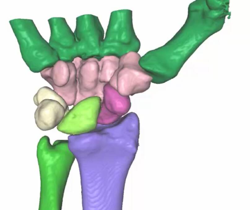 The True Life Anatomy 3D software shows the wrist. Picture Supplied The True Life Anatomy 3D software shows the wrist. Picture Supplied