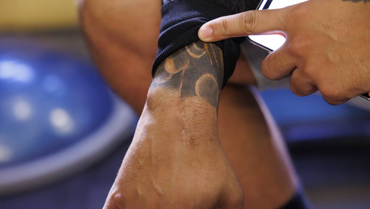 Nick Kyrgios shows the scar on the top part of his wrist from the ANAFAB surgery. Picture by Keegan Carroll. Nick Kyrgios shows the scar on the top part of his wrist from the ANAFAB surgery. Picture by Keegan Carroll.